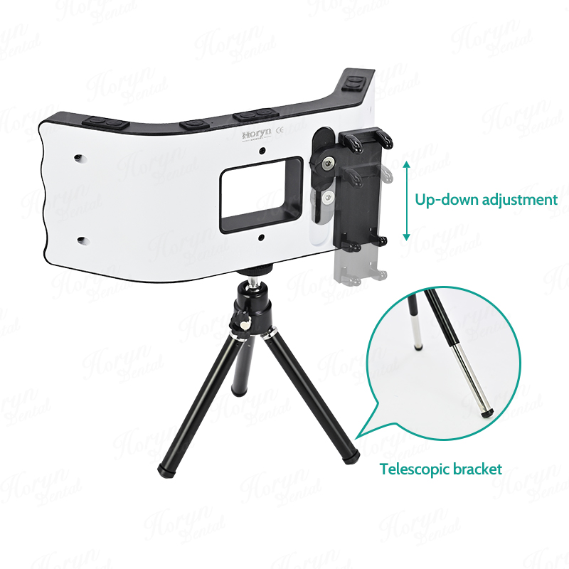 Dental Photography Kit Mobile  - đánh giá và giá Photography Lighting Spotlight